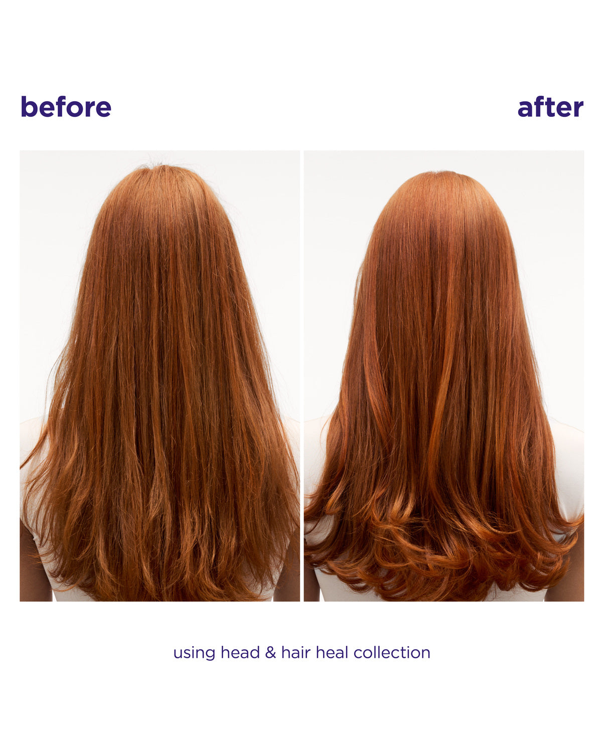 Head & Hair Heal Shampoo Liter